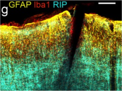 Read more: The Neuroprostheses Research Lab – Kevin Otto